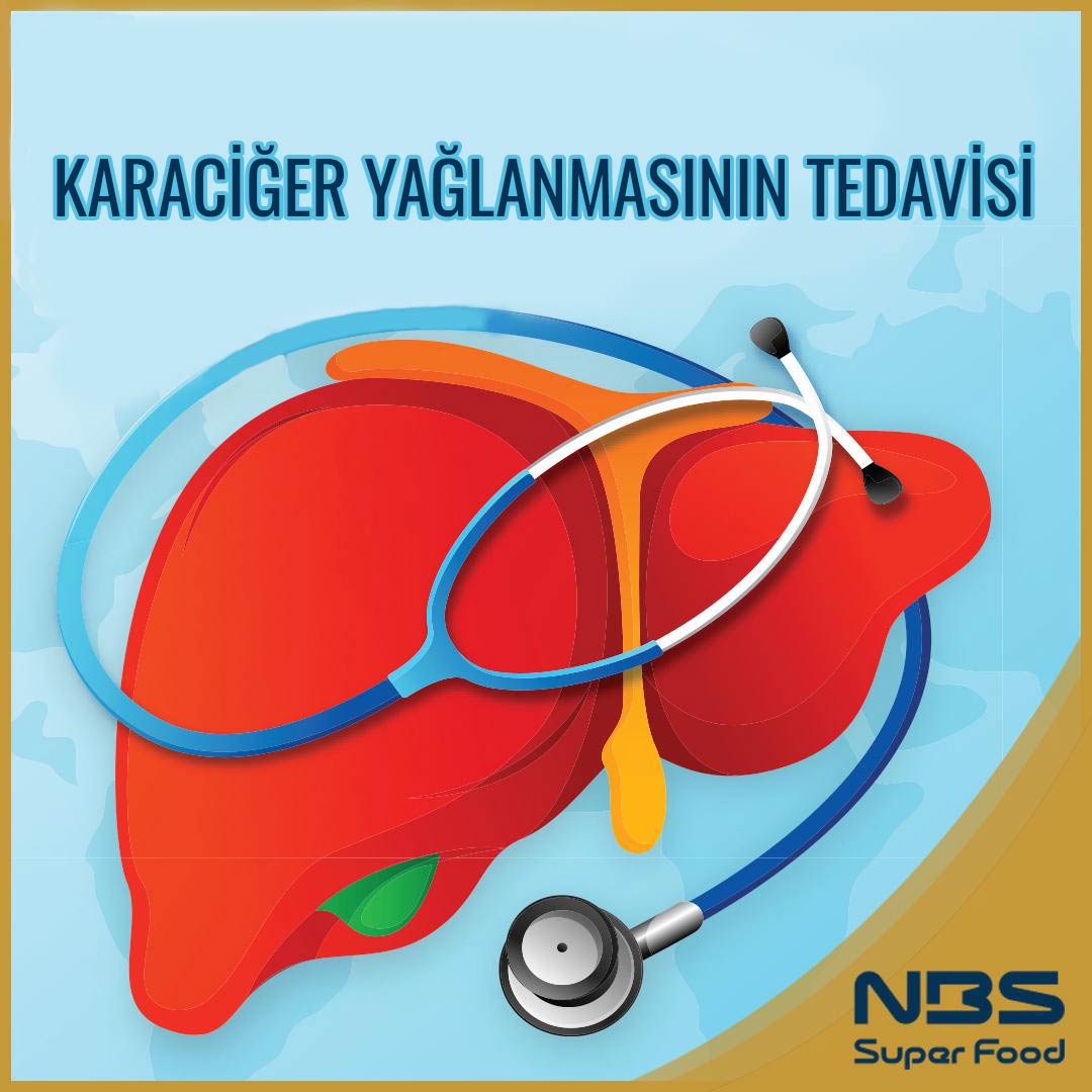 KARACİĞER YAĞLANMASININ TEDAVİSİ